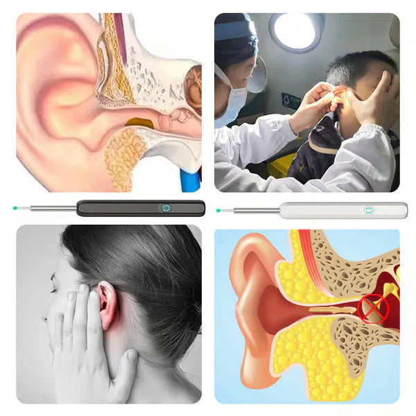 Easy Ear Cleaner Kit With Camera