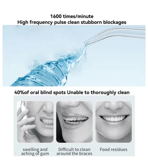 Smart Oral Irrigator Deep Clean & Fresh Breath in Seconds
